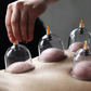 Verdikte vacuüm cupping-set met afzuigpomp