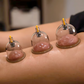 Verdikte vacuüm cupping-set met afzuigpomp